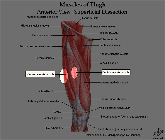 Deltoid Muscle Injection deltoid injection